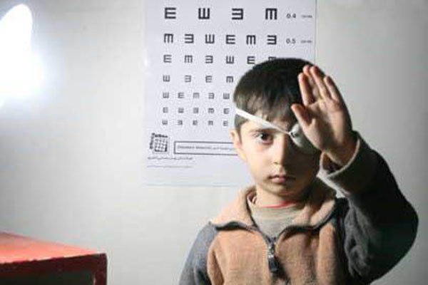 تنبلی چشم