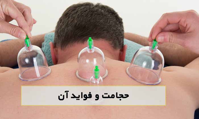 حجامت و فواید آن