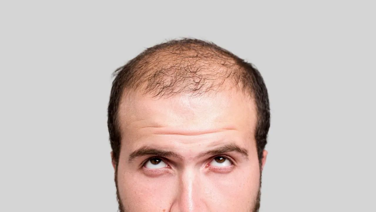 کچلی