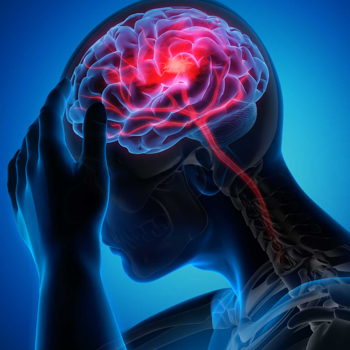 تومور مغزی