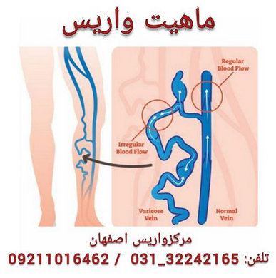 رپرتاژ