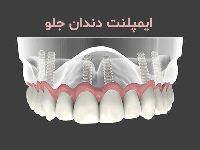 رپرتاژ