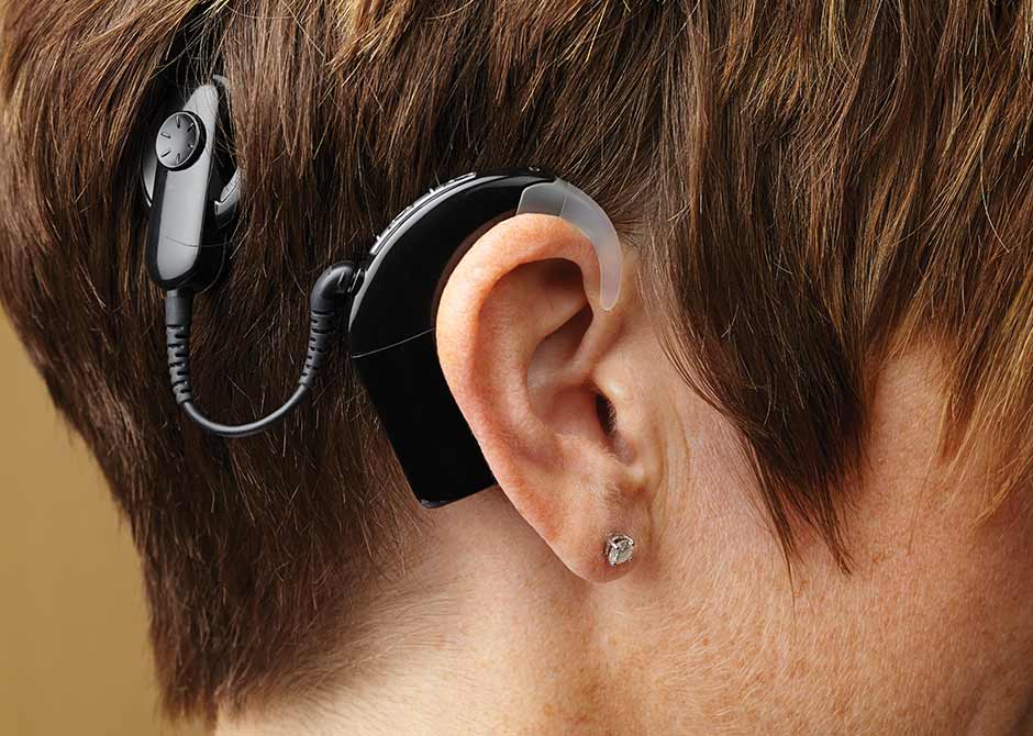 CochlearImplantFF.jpg