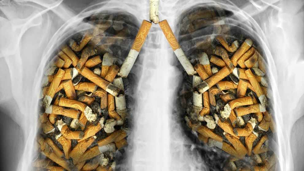 Lung-Cancer-Center-Causes-Types-Symptoms-Stages-Cancer-Research-UK-4.jpg