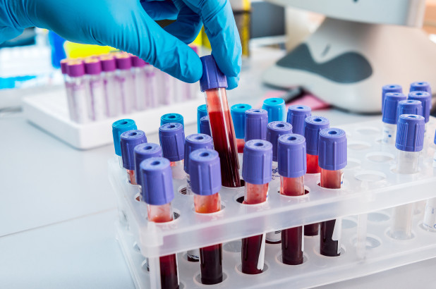 blood-test-dana-farber.jpg