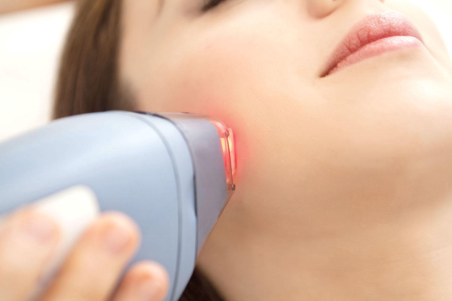 aser-hair-removal1.jpeg