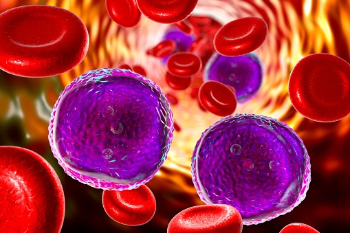DocWireBlog_LeukemiaSymptoms.jpg