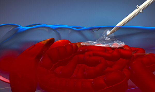 Foam-injection-Schematic-Web.jpg