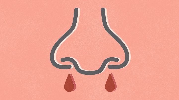 nosebleed-possible-causes-722x406.jpg
