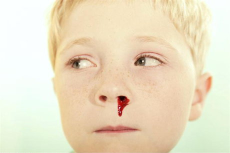 boy_with_bloody_nose_fan1004289-th3.jpg