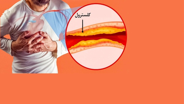 13499650_830.jpg