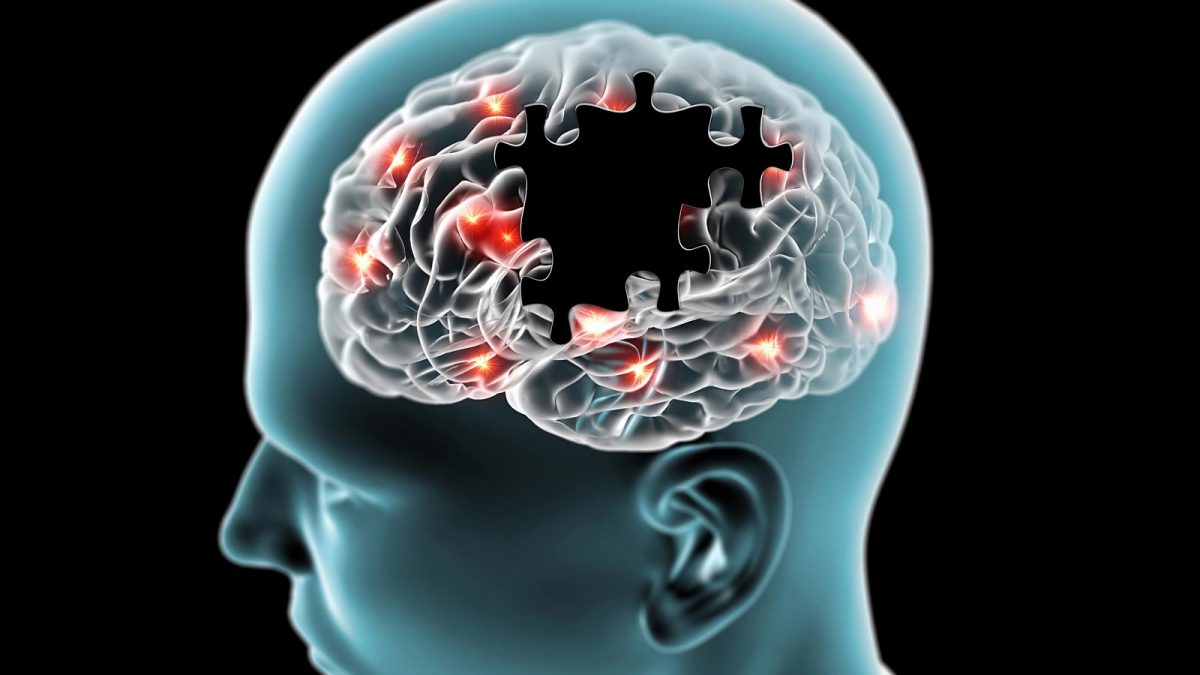 alzheimers-treatment-1200x675.jpg