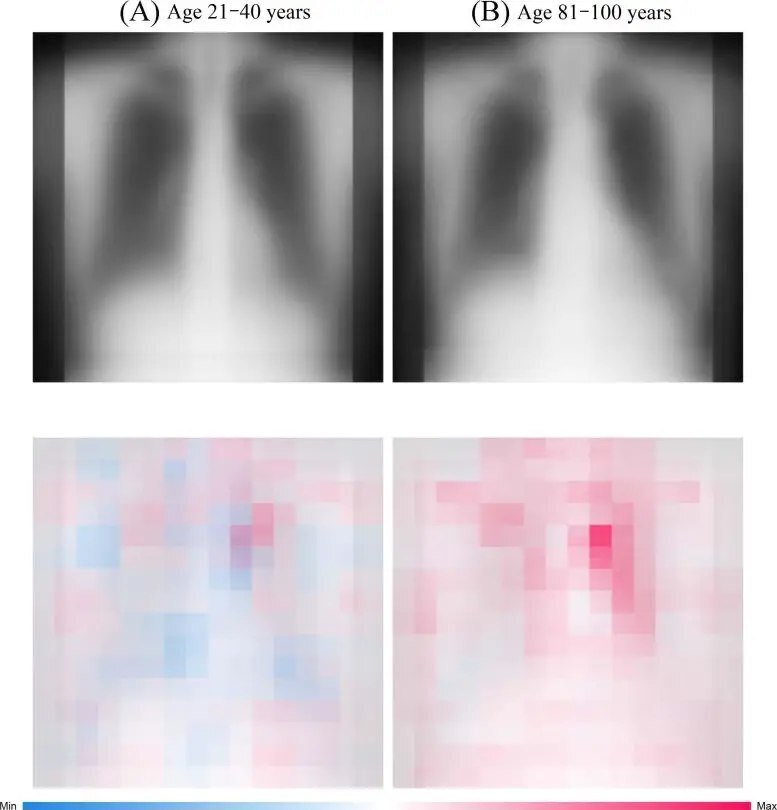 تحديد العمر الدقيق للبشر عن طريق فحص الصدر