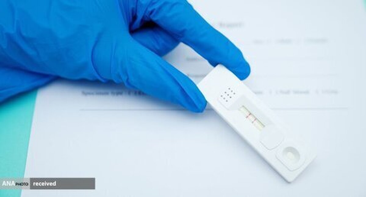 اولین کیت آزمایش خانگی تشخیص آنفلوانزا و کرونا تایید شد