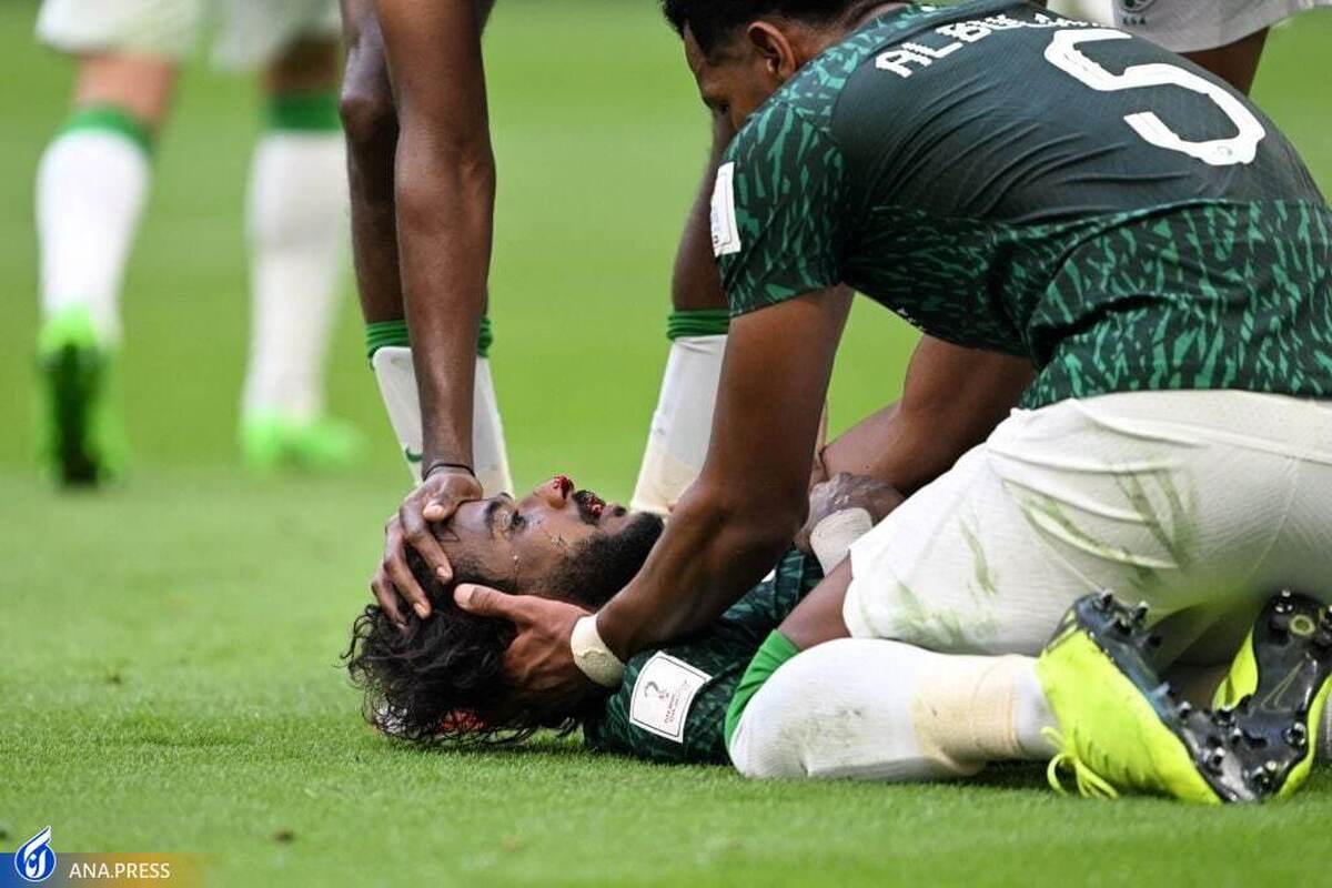 الشهرانی: هیچ چیز از مصدومیتم مقابل آرژانتین به یاد ندارم