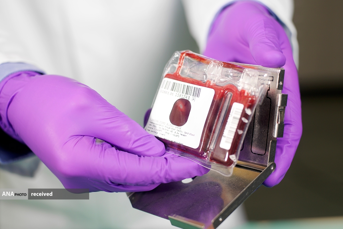 از راه‌اندازی اولین پالایشگاه محصولات زایمانی تا تولید زخم‌پوش از پرده‌های جنینی