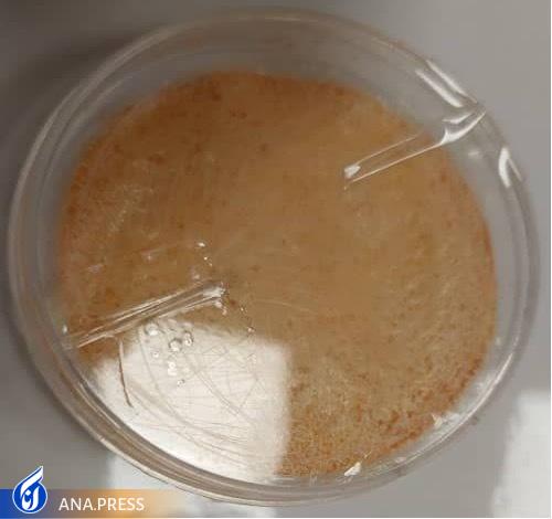 خبری خوش برای بیماران دیابتی/ رونمایی از محصولی دانشبنیان که از قطع عضو دیابتیها جلوگیری میکند خبری خوش برای بیماران دیابتی/ رونمایی از محصولی دانشبنیان که از قطع عضو دیابتیها جلوگیری میکند