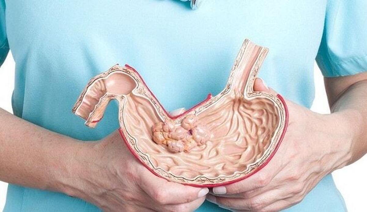 تزریق سم به معده/ لاغری به قیمت جان