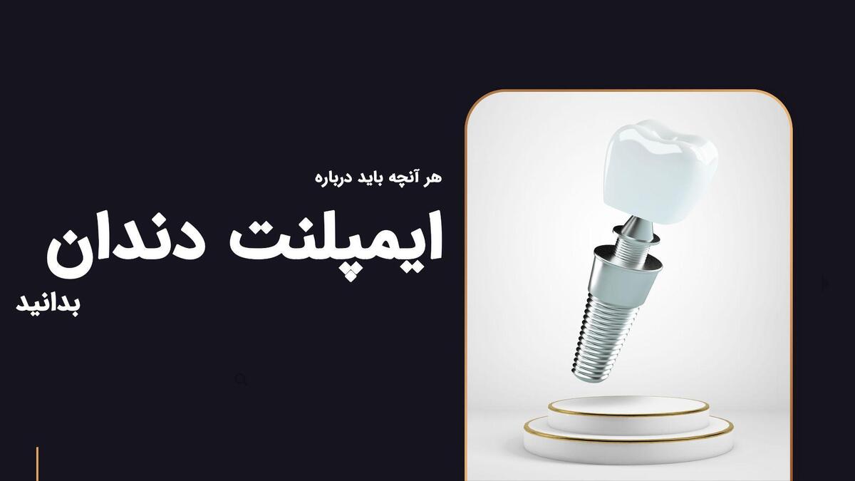 هر آنچه باید درباره ایمپلنت دندان بدانید از ترس تا اعتماد