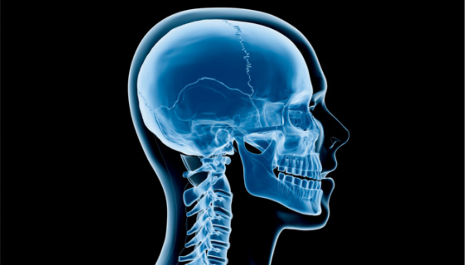 منبع نور اشعه ایکس چیست؟ منبع نور اشعه ایکس چیست؟