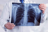 منبع نور اشعه ایکس چیست؟