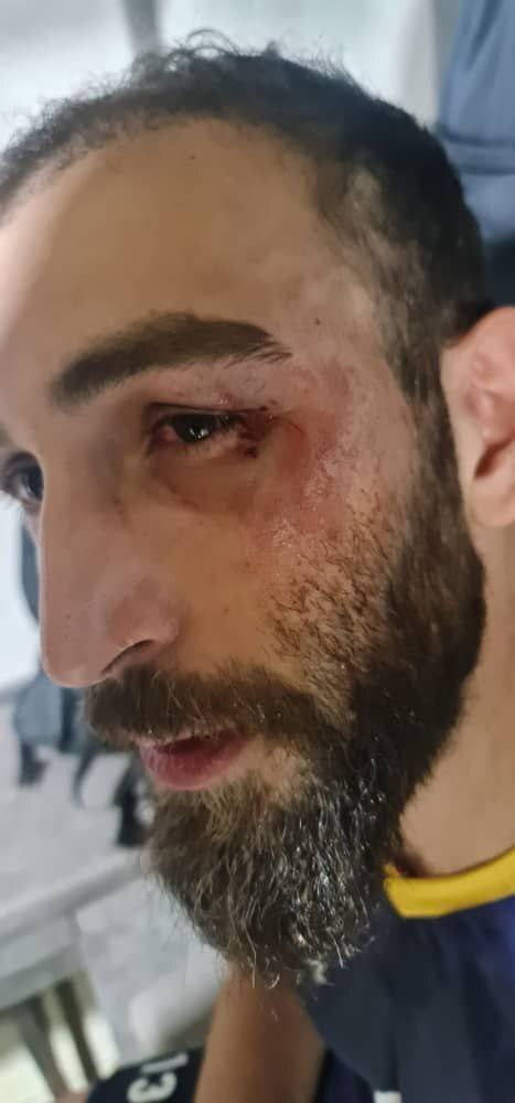 شب جنجالی والیبال، از درگیری فیزیکی در گرگان تا عدم حضور بازیکنان سپهرصدرا در زمین/ ناظران دیدارها کجا هستند؟ +فیلم شب جنجالی والیبال، از درگیری فیزیکی در گرگان تا عدم حضور بازیکنان سپهرصدرا در زمین/ ناظران دیدارها کجا هستند؟ +فیلم