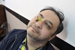 یک تیر و چند نشان با پرورش حلزون کُلاژن‌ساز