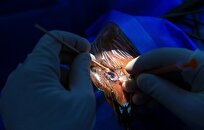 خطر نابینایی و عوارض جبران‌ناپذیر جراحی تغییر رنگ چشم