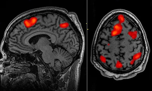 تبدیل افکار خاموش ذهن به گفتار| ابزاری که اندیشه را واژه میکند! تبدیل افکار خاموش ذهن به گفتار| ابزاری که اندیشه را واژه میکند!