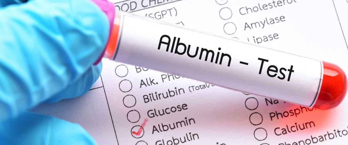 داروهای IVIG و آلبومین پرهزینه‌ترین داروی بیمارستانی