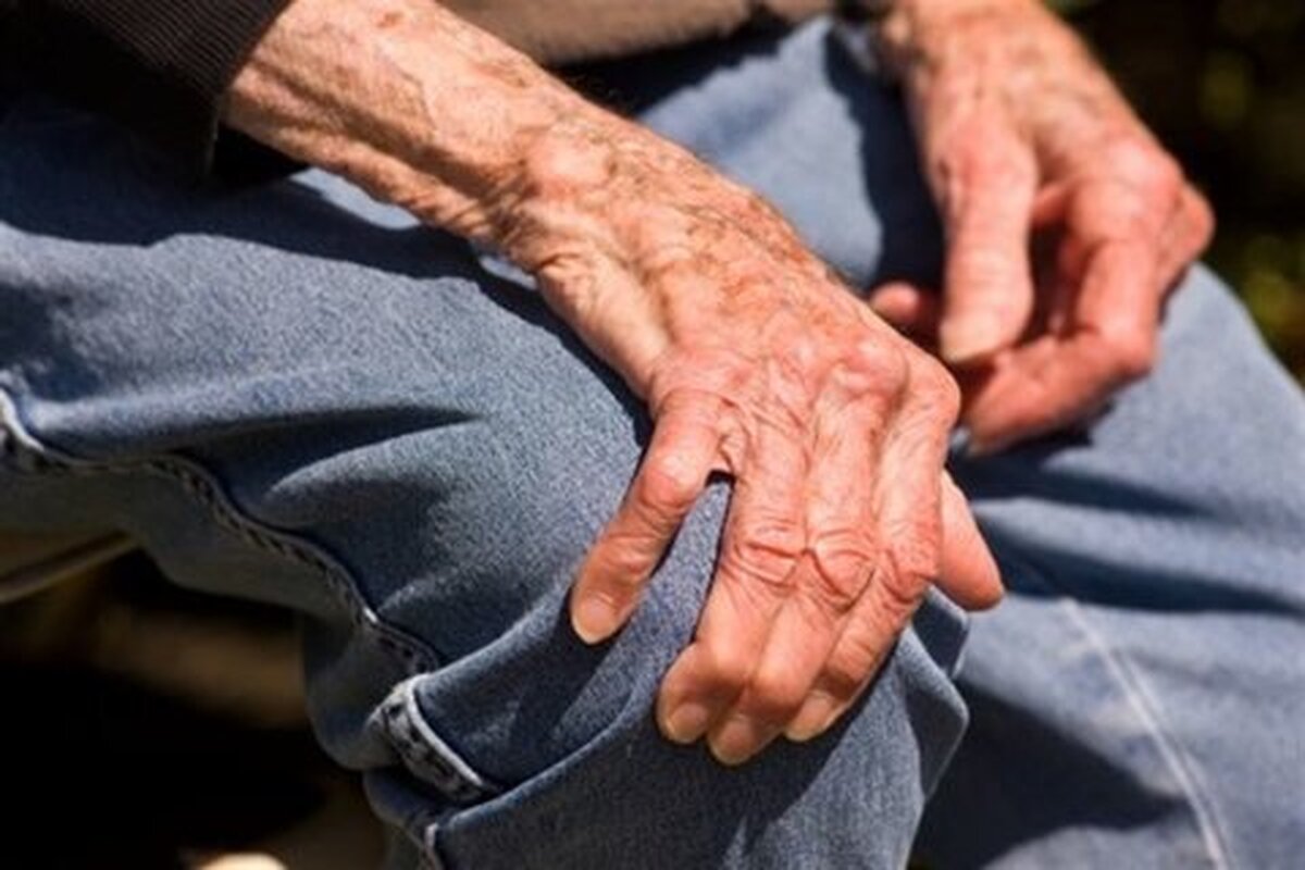 از نشانههای کمبود کلسیم تا پوکی استخوان و درمان آن
