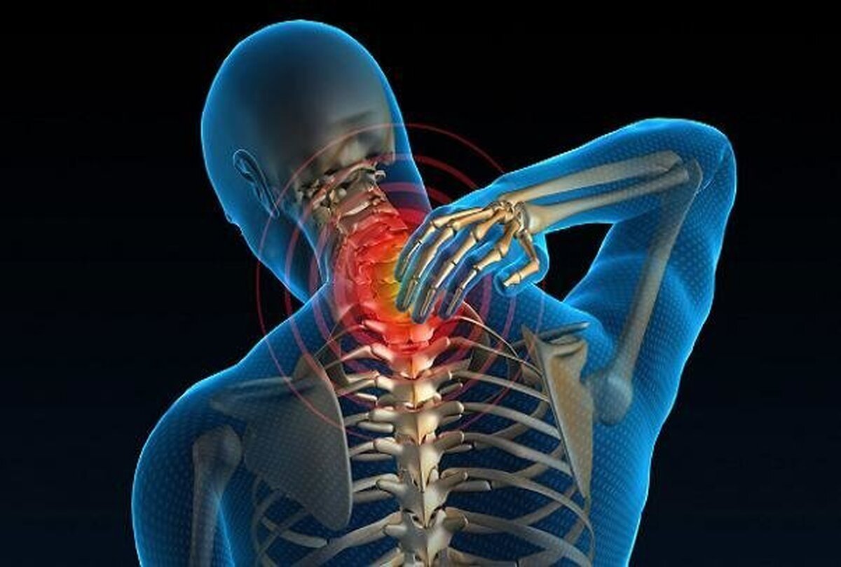گردندرد شایعترین درد فیزیکی ایرانیان/ افزایش قد با ورزش امکانپذیر است؟