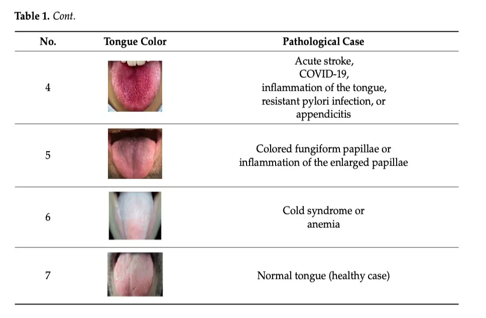 زبان درازی کنید؛ هوش مصنوعی بیماریهایتان را شناسایی کند زبان درازی کنید؛ هوش مصنوعی بیماریهایتان را شناسایی کند