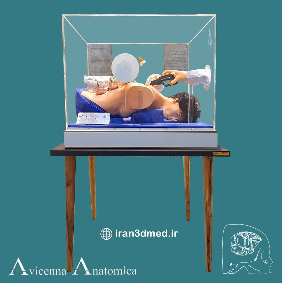 تسهیل انتقال مفاهیم پزشکی با ساخت مولاژ&zwnj;های اختصاصی