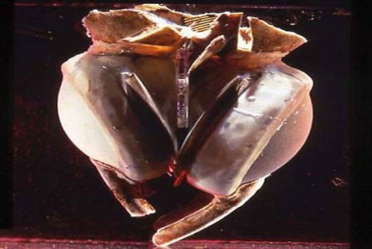 فناوری پزشکی به سمت تکامل؛ قلبهای تیتانومی جایگزین قلبهای پیوندی از مرگ مغزی میشوند؟ فناوری پزشکی به سمت تکامل؛ قلبهای تیتانومی جایگزین قلبهای پیوندی از مرگ مغزی میشوند؟