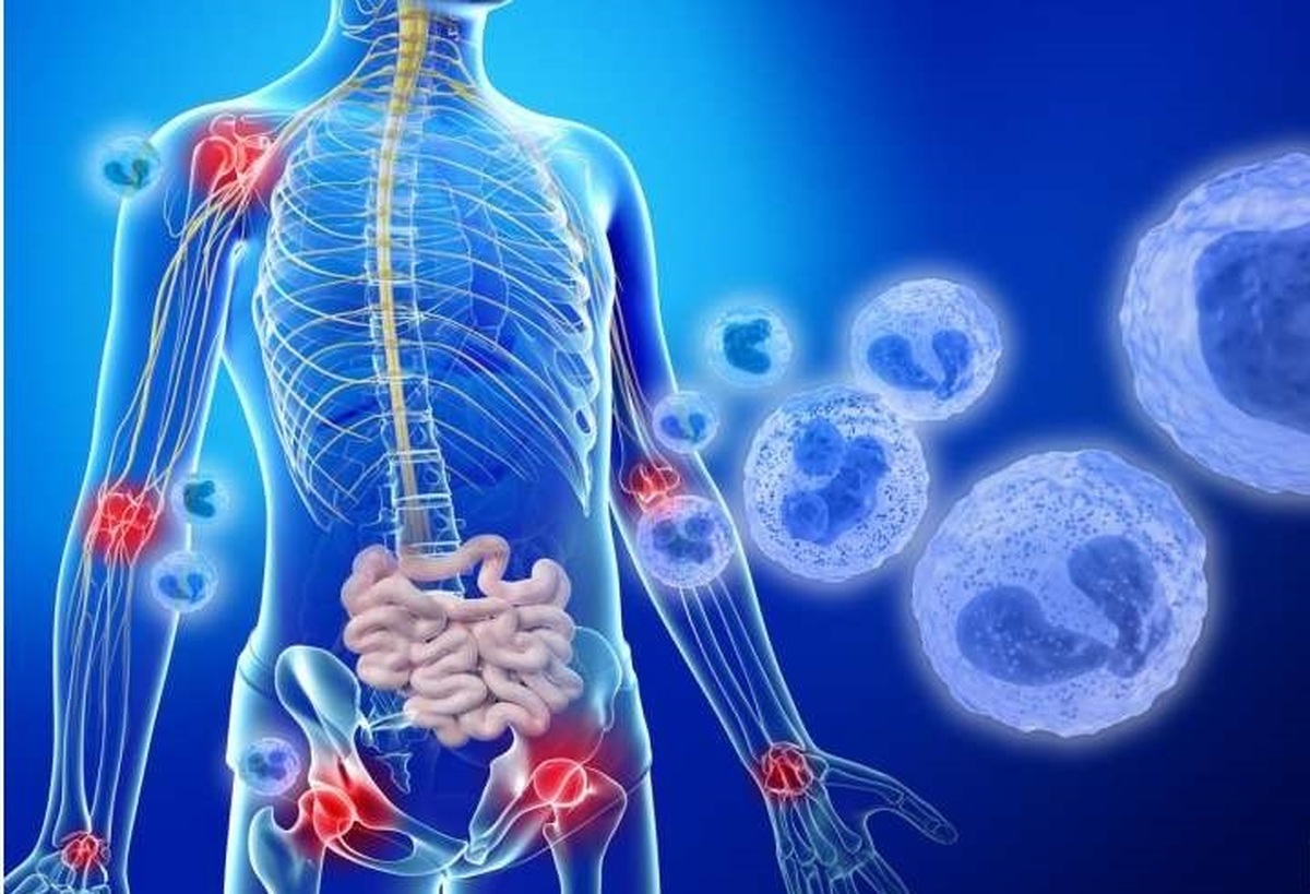 نقش رژیم غذایی مناسب در کاهش شاخصهای التهابی بدن