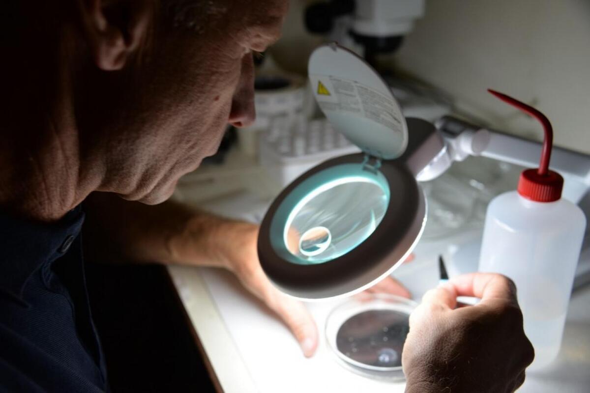 چرا انباشتگی ریزپلاستیک‌ها در مغز بیش از سایر اندام‌های بدن است