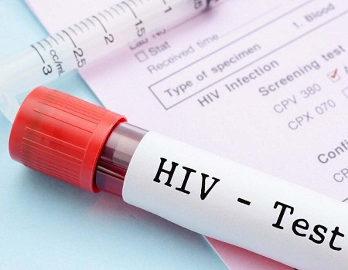 پویش سراسری تست اچآیوی برگزار میشود