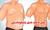 صفر تا صد عمل ژنیکوماستی، از فرآیند تا هزینه، ماندگاری و مراقبتها