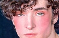 سرخ شدن صورت؛ واکنشی منحصر به انسان