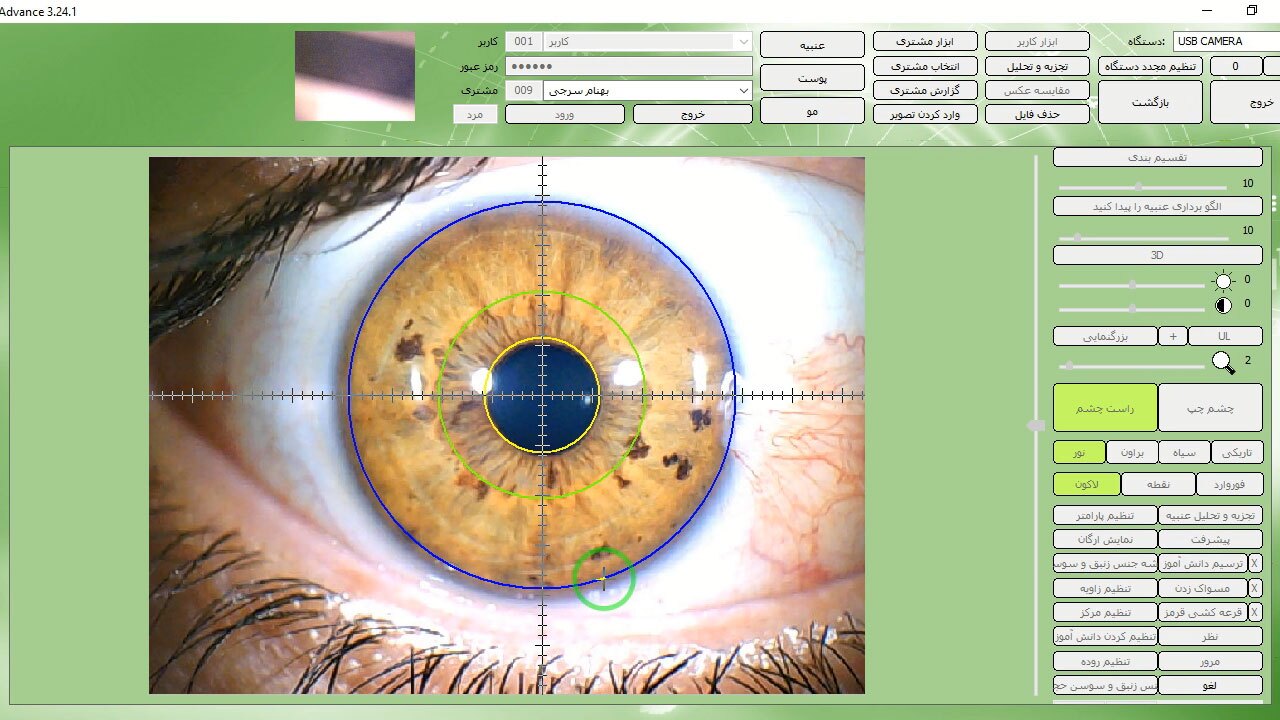 چشم در برابر علم؛ آیا عنبیه واقعاً راز سلامتی را فاش میکند؟ چشم در برابر علم؛ آیا عنبیه واقعاً راز سلامتی را فاش میکند؟