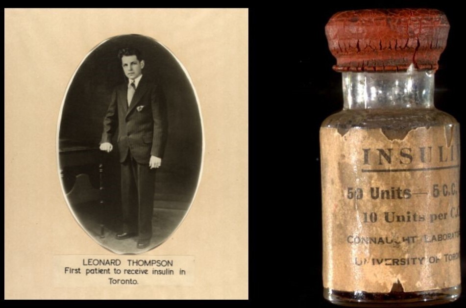 مورد اتفاقی لوزالمعده| قند خون بهجای اسیدهای چرب روده مورد اتفاقی لوزالمعده| قند خون بهجای اسیدهای چرب روده