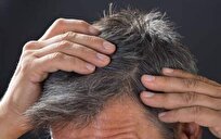 تغییر رنگ مکرر موها به قیمت ریزش و التهاب پوست سر