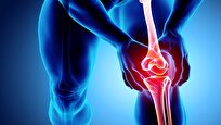 شایعترین دلیل ابتلا به آرتروز چاقی است