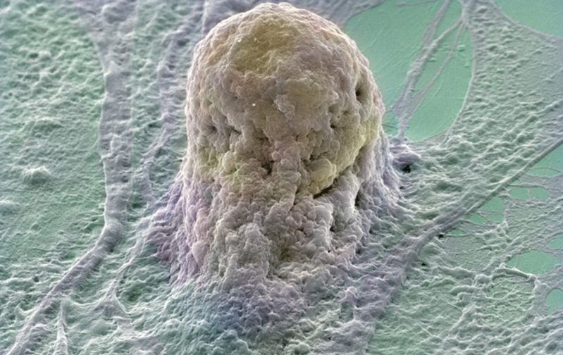سلولهای بنیادی، تجارت و پرتگاه اخلاق یا نجات و رویای شفا سلولهای بنیادی، تجارت و پرتگاه اخلاق یا نجات و رویای شفا