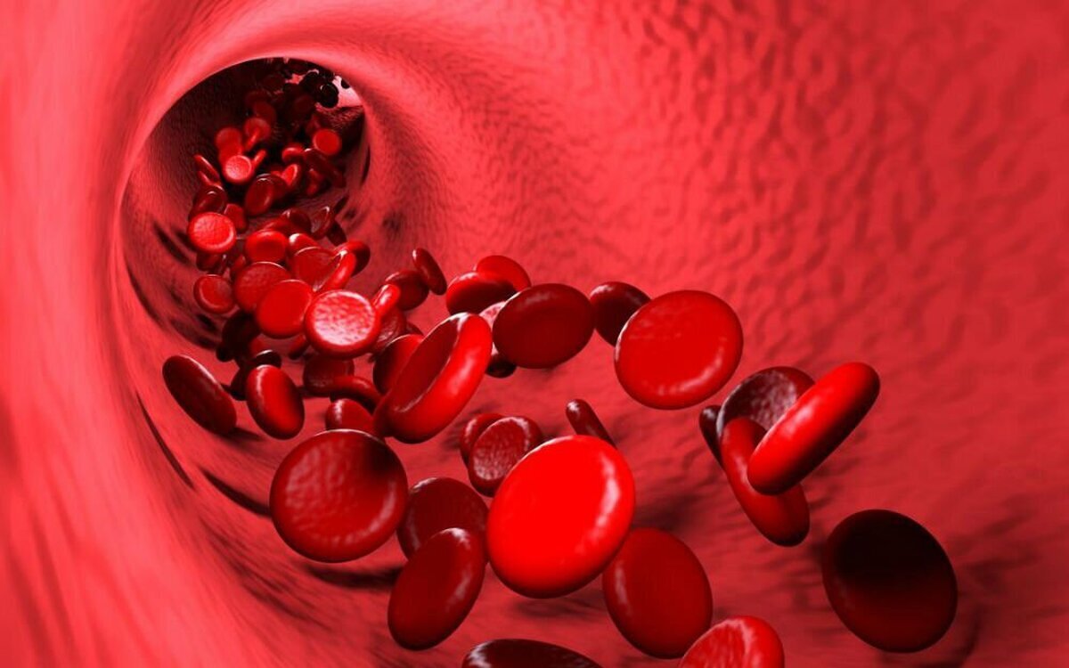 بتا تالاسمی مینور؛ کمخونی ارثی و امکان زندگی طبیعی با مدیریت صحیح