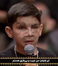 کودک جانباز لبنانی مهمان حسینیه معلی شد+ فیلم