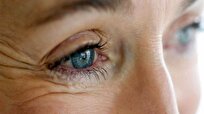 تبلیغات غیرمجاز قطرههای چشمی در شبکههای اجتماعی