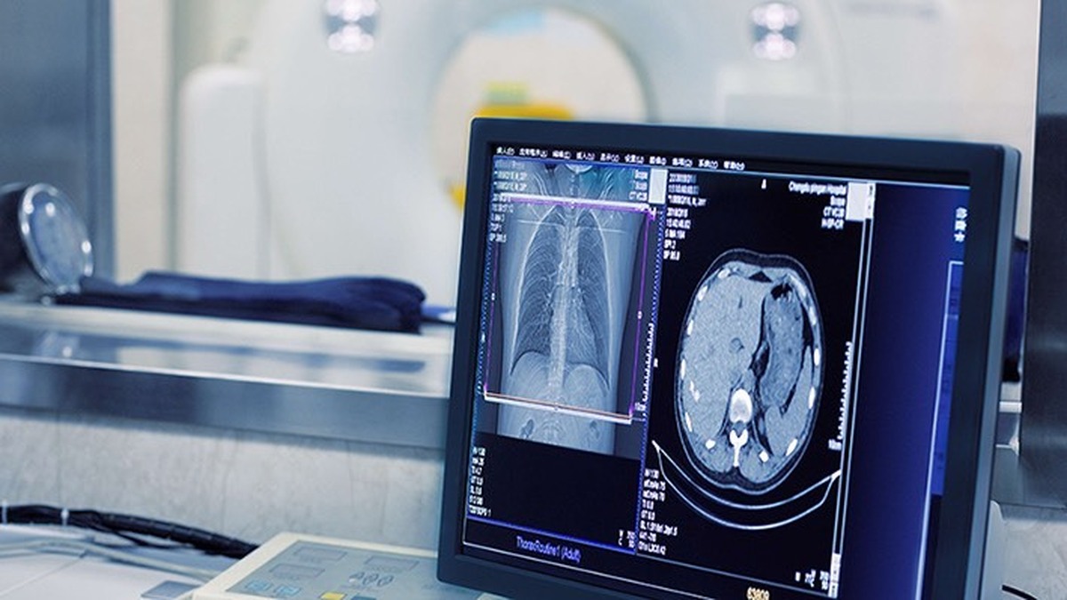 سکوی هوشمند AIMEDIC؛ دستاورد فناورانه ایرانی در تحلیل تصاویر پزشکی