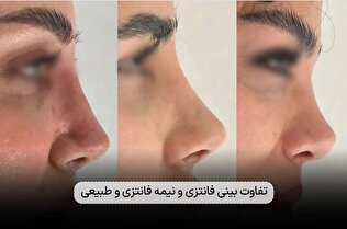 تفاوت بینی فانتزی و نیمه فانتزی و طبیعی؛ راهنمای حرفهای برای تصمیمگیری آگاهانه